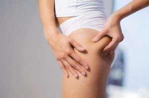rimedi anti cellulite