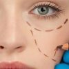 chirurgia plastica