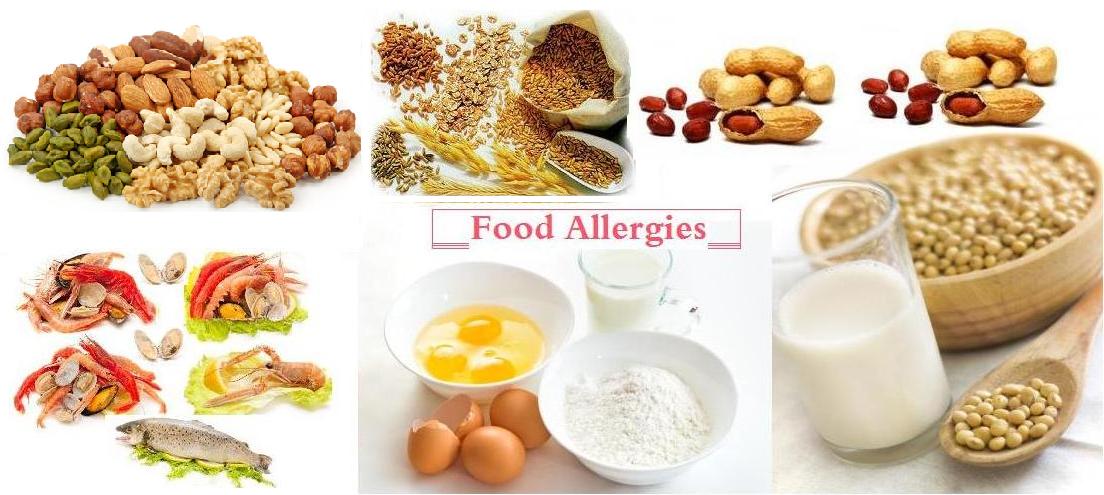 allergie cibi