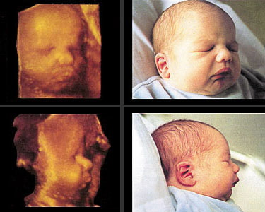 articolo-2-immagine-3