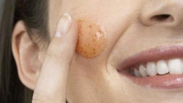 curare cicatrici acne